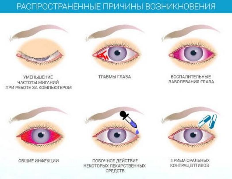 Comment préparer de la gelée d'avoine médicinale.  Gelée d'avoine à base de flocons d'avoine, de flocons d'avoine, d'avoine entière.  Avantages et contre-indications de la gelée d'avoine.  Comment préparer la gelée d'avoine ?  Gelée d'avoine pour perdre du poids