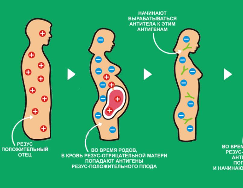 Les nouilles aux œufs Rollton nuisent.  Quels sont les avantages et les inconvénients des nouilles instantanées pour les adultes.  Production de nouilles instantanées