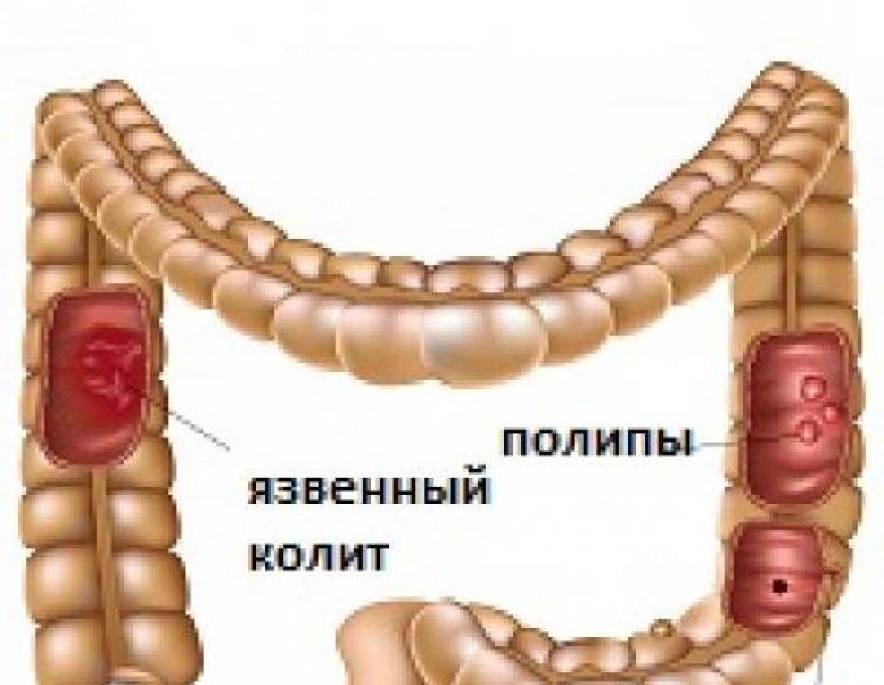 Маш в кулинарии. Маш (фасоль золотистая или бобы мунг). Использование в кулинарии