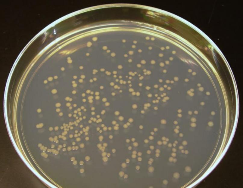 Qu'est-ce que le kmafanm en microbiologie.  © Laboratoire vétérinaire régional de Kogbu Kirov.  Détermination du nombre total de bactéries